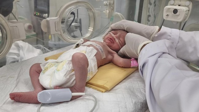 bayi di gaza diselamatkan dari rahim ibunya yang dibunuh israel