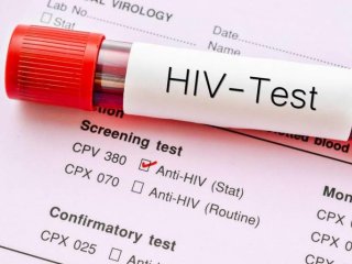 561 Orang Terkonfirmasi HIV Positif, Kemana KPA Kota Bekasi?