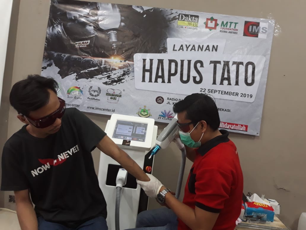 Radio Dakta bersama IMS mengadakan layanan hapus tato